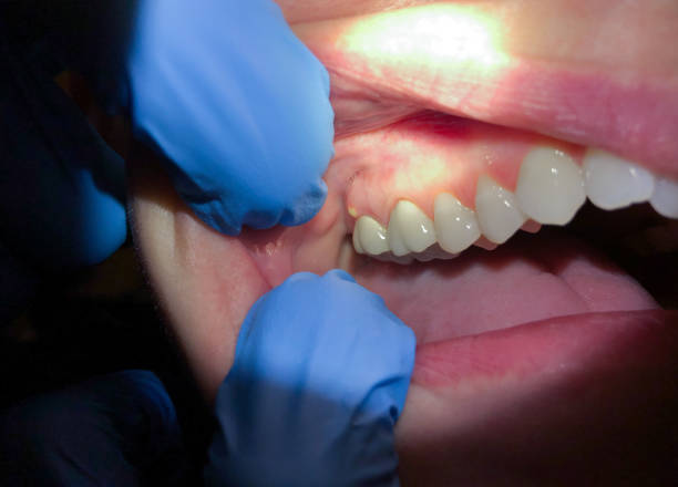 Best Emergency Dentist for Special Needs Patients in Aubrey, TX