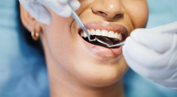 Best Emergency Root Canal Treatment in Aubrey, TX
