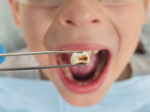 Best Mobile Emergency Dentist in Aubrey, TX