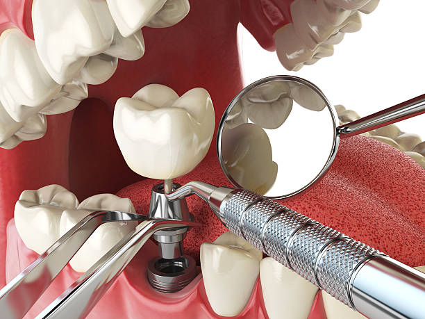 Best Broken or Cracked Tooth Emergency Dentist in Aubrey, TX